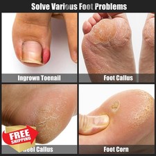 7pc Ingrown Toenail Treatment Removal Kit Pedicure Tools