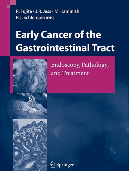 Early Cancer Of The Gastrointestinal Tract R. Fujita-image