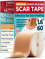 Medical Grade Silicone Scar Tape - 1.6 x60 - Visible 60"x1.6", Beige