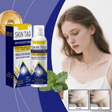 Chill Erase Bump Renewal Spray Precise Cryo Recover RootWarts Targets NeAMK S5P5