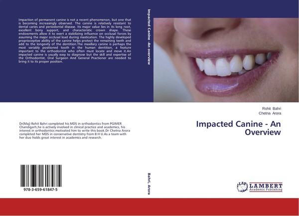 Rohit Bahri (U. A.) | Impacted Canine - An Overview | Taschenbuch | Englisch-image