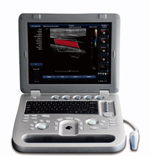 NEW High Quality Veterinary Color Ultrasound Scanner with Two Probes