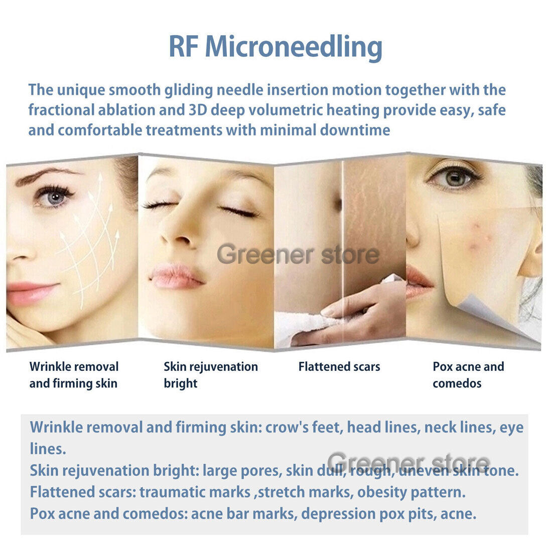 7D RF-Fractional Micron-ee-dle Machine Skin Rejuvenation 7D RF-Fractional Micron-ee-dle Machine Skin Rejuvenation