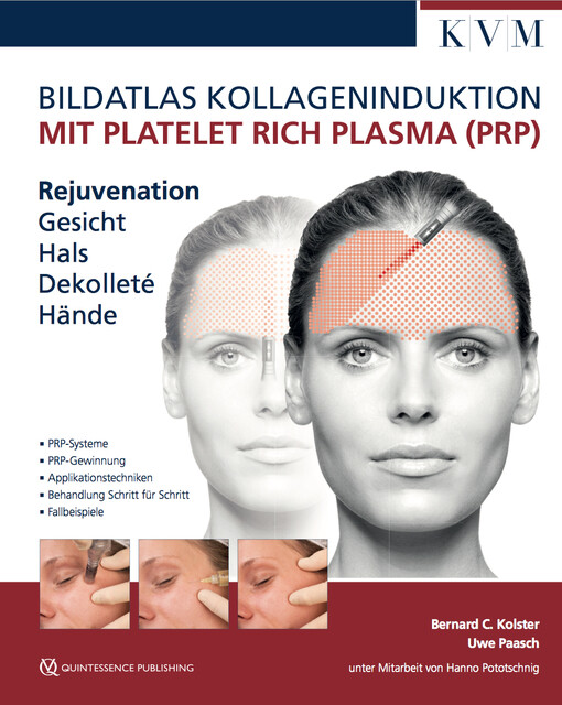 Thumbnail - Bildatlas Kollageninduktion Mit Platelet Rich Plasma (prp) Uwe Paasch