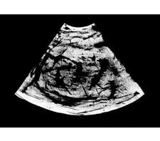 Original Art The Voice Series #1 by Pedro Soares Signed ‘16 Ink Drawing Portugal