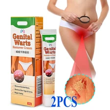 2x Wart Remover Genital Ointment Herpe Cream Acuminatum Antibacterial Treatment