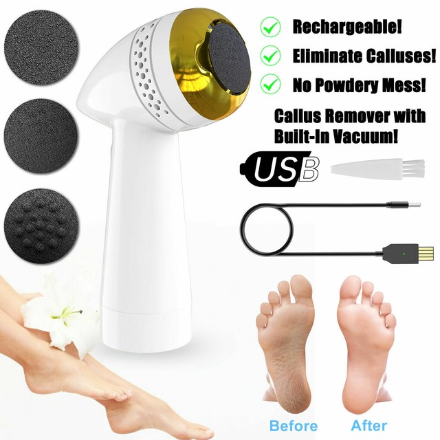Electric Pedivac File Grinder Dead Skin Callus Remover Easily For Foot