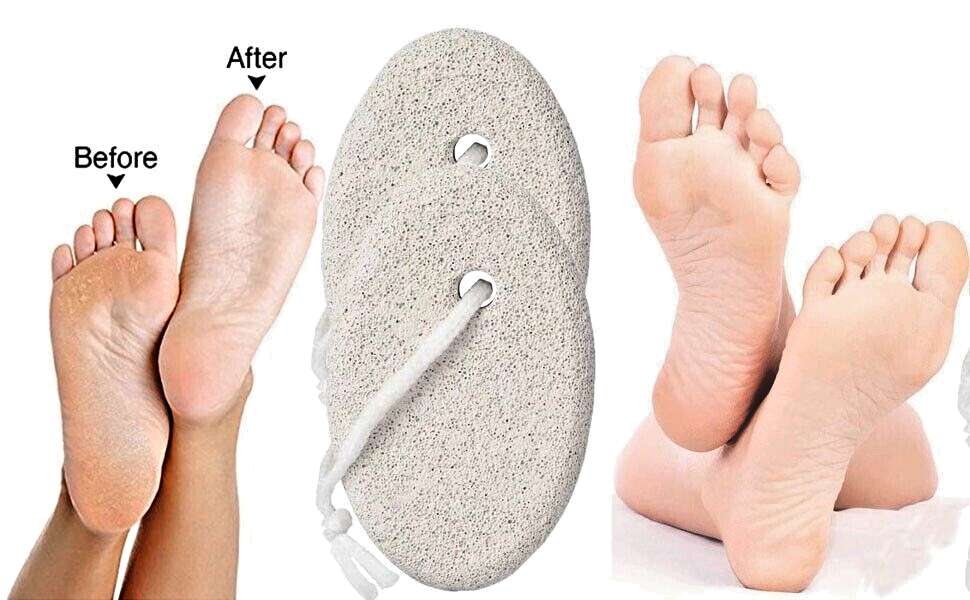 4-Pack Foot Pumice Stone for Feet - 4-Pack Pedicure Tools | eBay