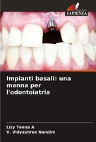 Lizy Teena A (U. A.) | Impianti Basali: Una Manna Per L'odontoiatria | Buch