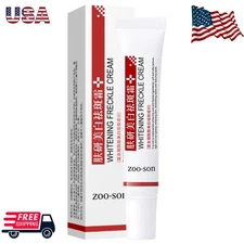 Effective Whitening Freckle Cream Remove Dark Spot Cream Removal Melanin Melasma