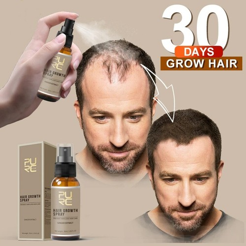 Caída De Cabello Spray Previene Y Crece El Cabello Nutritiva 30 ml Excelente - Picture 3 of 6