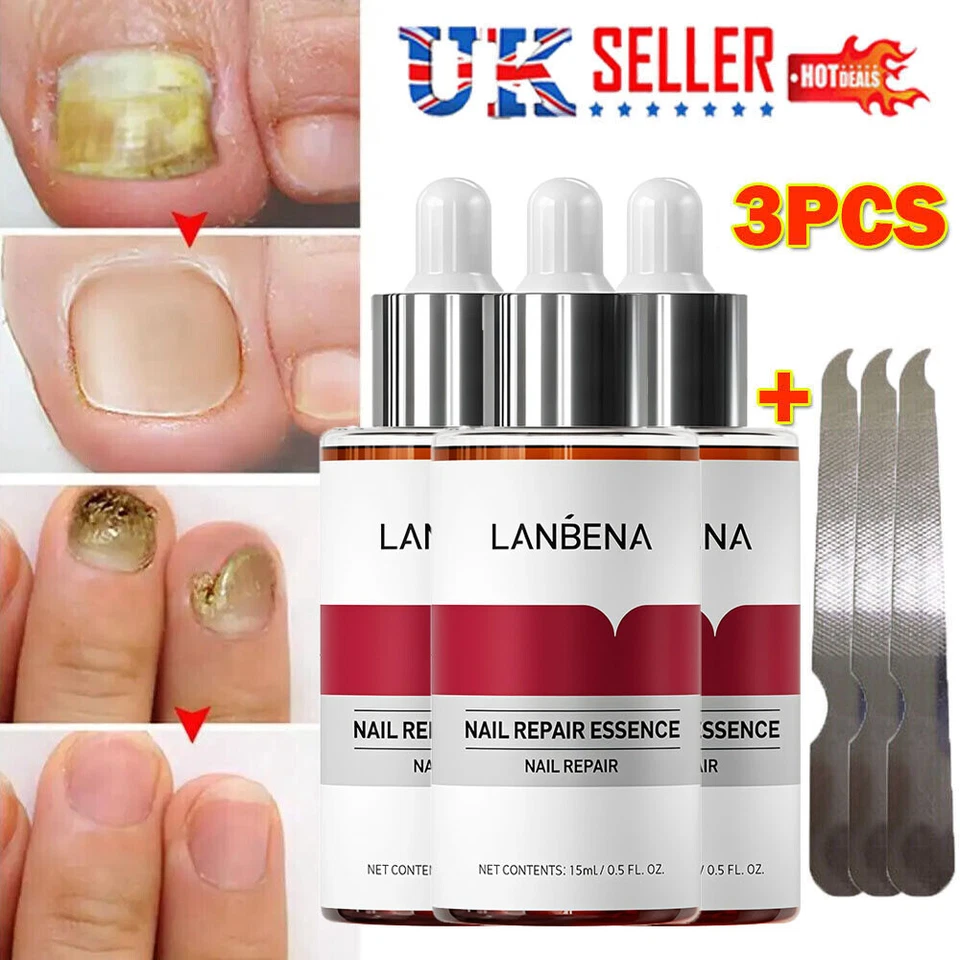 3x LANBENA Nail Repair Essence Remove Onychomycosis Serum Fungal Nail Treatment