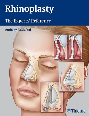 Rhinoplasty | Anthony P. Sclafani | englisch