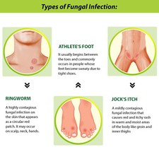 Tetmosol Anti-fungal Dusting Powder fights skin infections prickly heat, itching