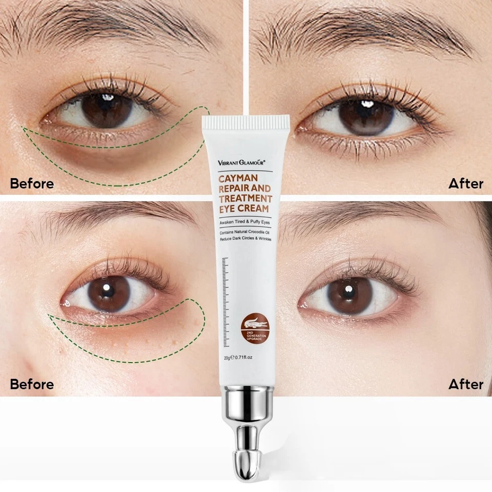 Crema Para Las Ojeras Anti-arrugas Remueve Bolsas en Los Ojos y Círculos Oscuros Foto 2 de 4