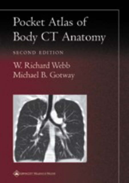 Pocket Atlas of Body CT Anatomy by Michael B. Gotway (Paperback Book)