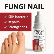 Fungi-Nail Anti-Fungal Liquid Solution Kills Fungus That Can Lead To Nail