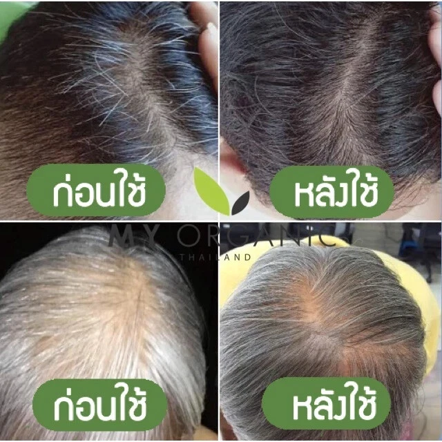 My Organic тоник для волос питание уменьшает выпадение волос сыворотка для роста волос - Изображение 4 из 4