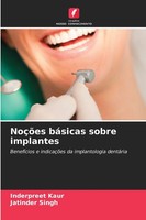 Inderpreet Kaur (U. A.) | NoçõEs BáSicas Sobre Implantes | Taschenbuch (2025)