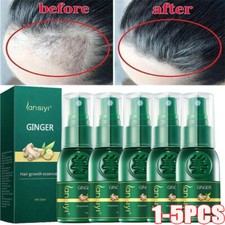 1-5x Ginger Ginseng Hair Regrowth Serum Spray Growth Essence Anti-Loss Treatment