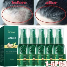 Fast Hair Growth Spray Anti Hair Loss Fast Regrowth Scalp Treatment Serum 30ML