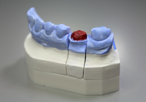 10 Basi metà per modelli dentali applicabili su 'articolazione con 2 gomme - Foto 10 di 11