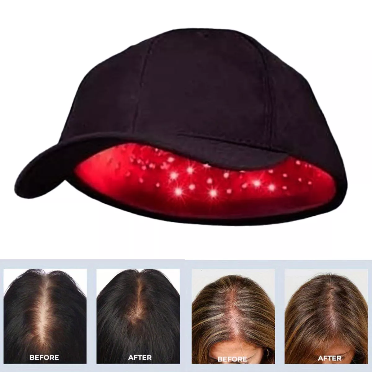 Red light & Near Infrared LED Therapy Hat For Hair Growth & Brain Function  | eBay