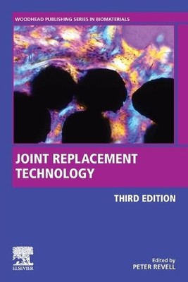Joint Replacement Technology - 9780128210826