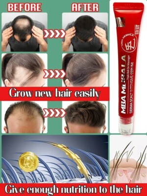 Behandlung für Der Nachwuchs Der Haare Und Anti Verlust Öl Wachstum Serum Bio +