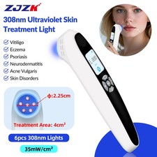 308nm UVB Light Therapy Device for Skin Diseases on Face Hands Legs White Spots