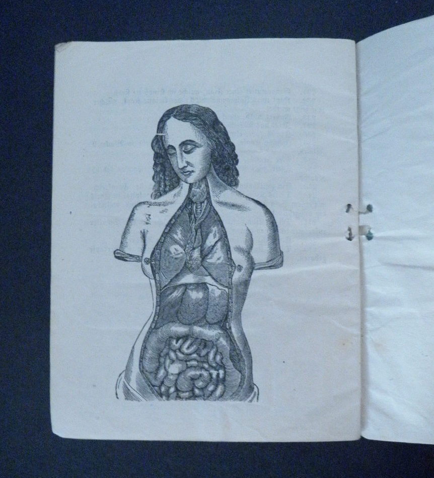 A. Bernstein's European Museum of Anatomy & Panopticum German Kansas