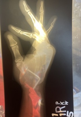 Creepy  Human Hand X-ray MRI Film Gothic Decor Medical Anatomy