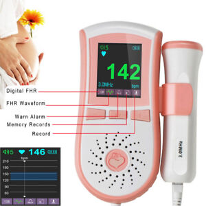 pregnancy baby heart rate monitor