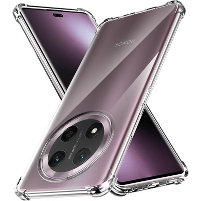 Hülle für Honor 400/Magic 7 Lite/X8/X7/90 Smart/ Cover transparent