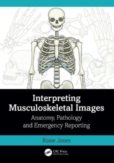 Interpreting Musculoskeletal Images : Anatomy, Pathology and Emergency Reporting - Image 5