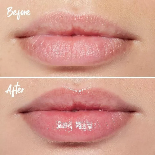 3D Lip Plumping Treatment My Instant Effects 5ml Long Lasting Fuller Lips - Bild 5 von 7