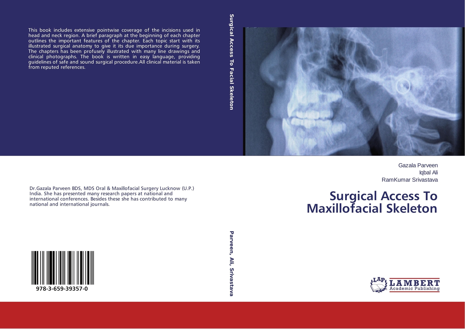 Thumbnail - Gazala Parveen (u. A.) | Surgical Access To Maxillofacial Skeleton |