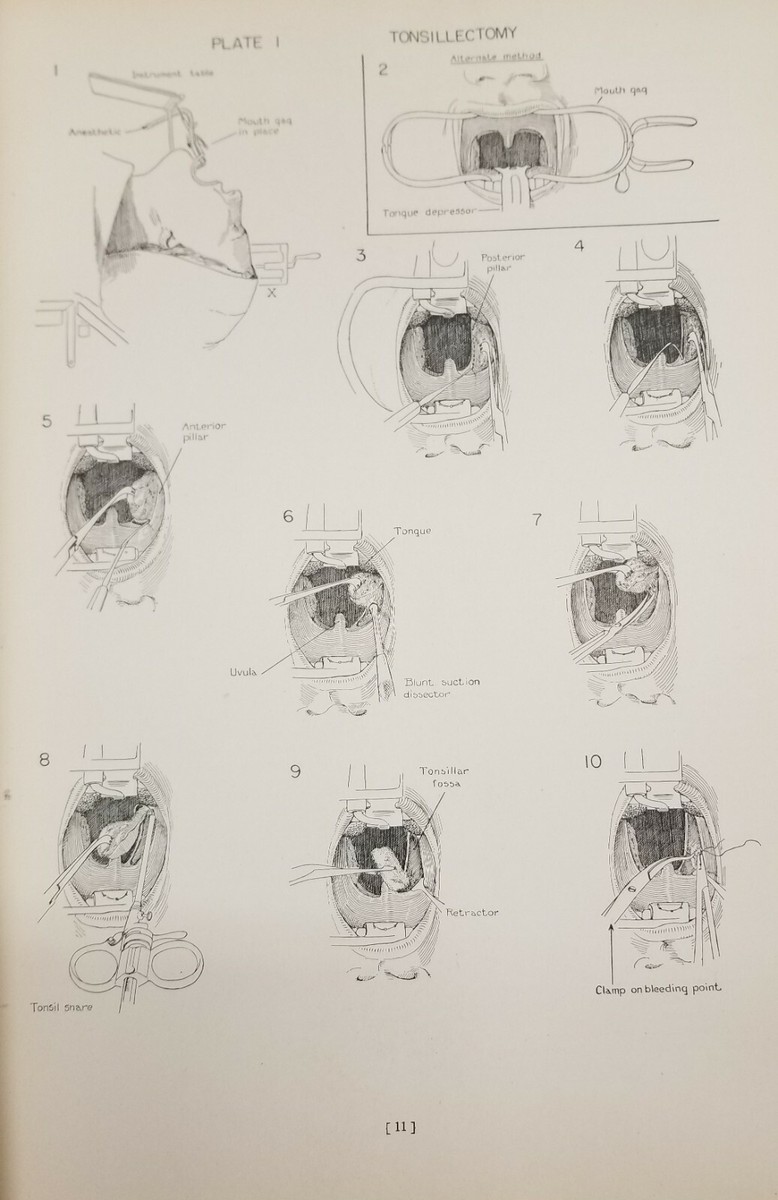 Atlas of Surgical Operations Cutler Zollinger Illustr 1939 (9th pr