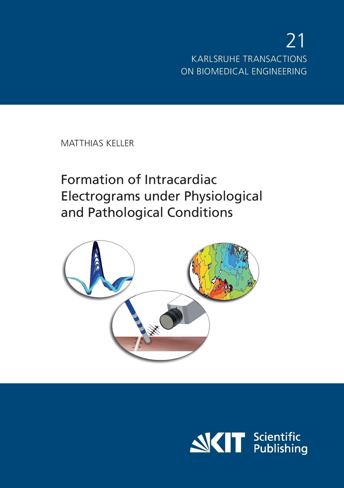 Thumbnail - Formation Of Intracardiac Electrograms Under Physiological And