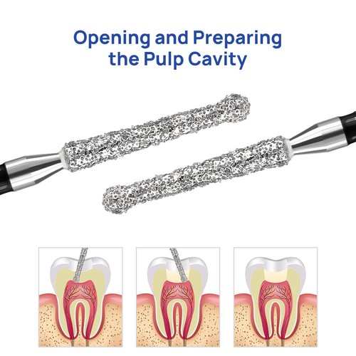 5Pcs Dental Diamond Burs Endo Access Bur Open Preparing Pulp Cavity Bur Hot Sale - Picture 19 of 47
