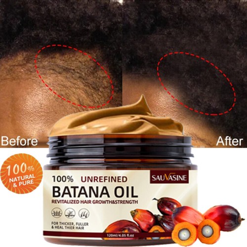 Batana Oil For Hair Growth,Pure Natural Botana Oil Cream Hair Loss Treatment - Picture 4 of 20
