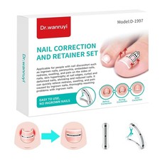 Titanium Alloy Silicone Ingrown Nail Correction Retainer Set New