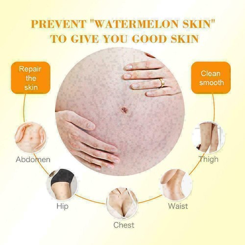 PASTEL pregnancy marks stretch marks scar remover Skin whitening B1R1 Cream E8W8 - Picture 6 of 12