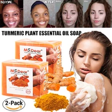 2PC Turmeric Soap Bar for Face & Body-Tumeric Soap,Acne, Dark Spots, Smooth Skin