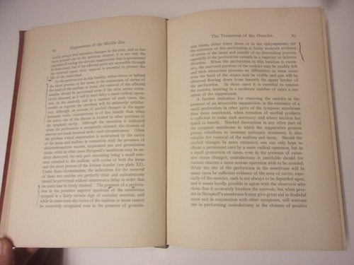 The Surgical Treatment of...the Middle Ear and Mastoid, Seymour Oppenheimer 1906 - Picture 12 of 16