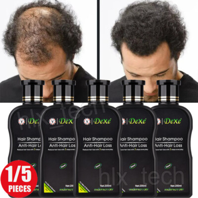 1-5Pc Dexe Hair Shampoo Anti hair Loss Chinese Natural Herbal Hair Growth Unisex