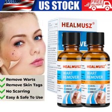 2PCS Wart Remover Liquid Skin Tag Mole Remover Eliminate Feet Corn Wart Remove