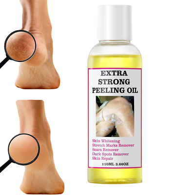 Strong Yellow Peeling Oil Exfoliating Solution For  Face Body Dark Skin Care New