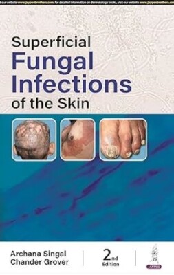 Superficial Fungal Infections of the Skin 2/e Archana Singhal Chander Grover Tra