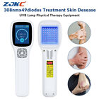 308nm Excimer System Blue Uv Light Therapy Device for Skin Diseases 49Diodes